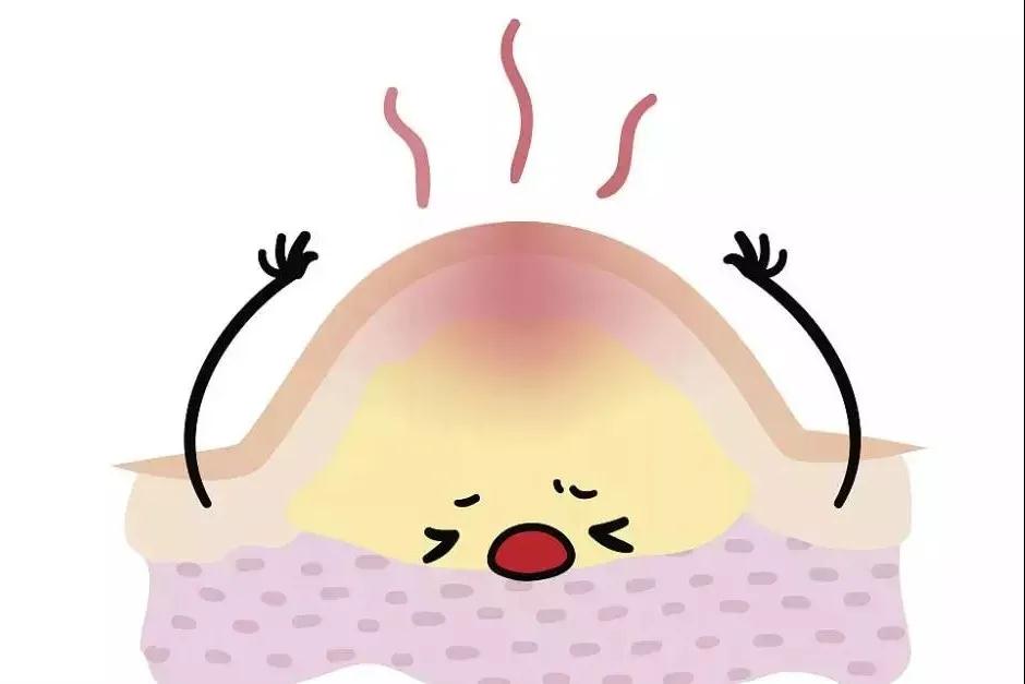 【科普】痘痘为何会反反复作?揭秘错误的战痘常识