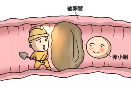 术后护理不当很容易引发宫腔内感染,引起宫腔粘连,炎症上行感染输卵管